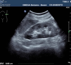 Sonographie Sonographie